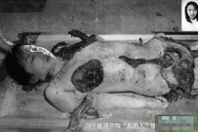 女战俘:被强奸后截掉四肢 蠕动身体无法自尽【