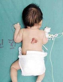 人体怪异现象 巴西美女脚底长出乳头