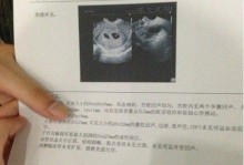 19岁怀孕<em>少女</em>网上晒<em>人工</em>流产全过程【1】-女人