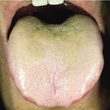 有病没病看舌头 专家:中医舌象确能反映身体状况(1