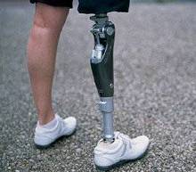 植入式脑芯片帮助行走