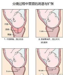分娩时的开十指是情趣?话意思.图片