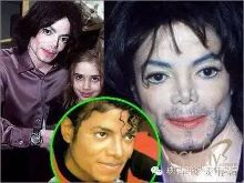 打肉毒素变面瘫,那些血淋淋的整容失败案例