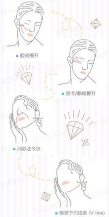 Dr.良心话 | 熬夜低头族必备抗衰项目之埋线提升