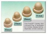宫颈帽是由软橡胶制成,像一个薄膜,一定要由医生推荐使用才行
