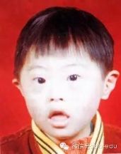 警惕:怀唐氏宝宝的胎动特征是这样的!图片
