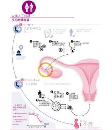 杭州供卵代怀：在繁复生活中的温柔陪伴